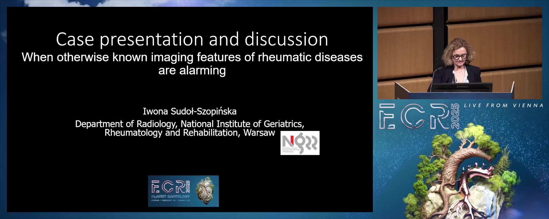 Case presentation and discussion: When otherwise known imaging features of rheumatic diseases are alarming