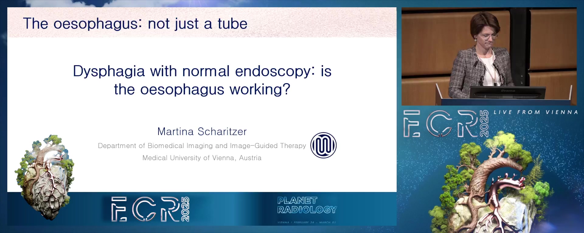 Dysphagia with normal endoscopy: is the oesophagus working?