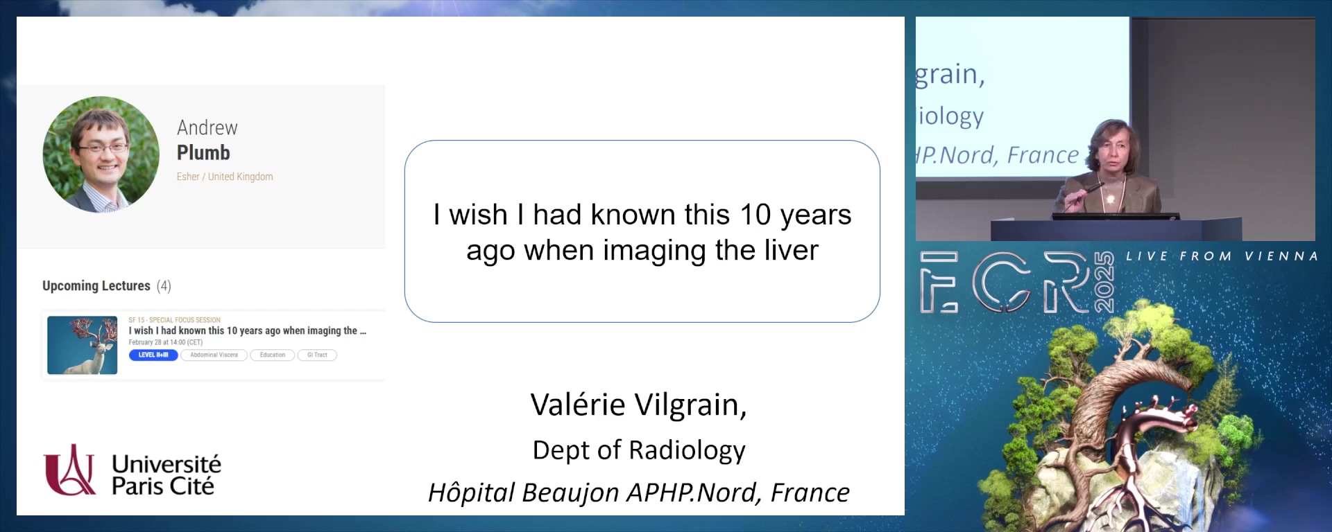 Liver