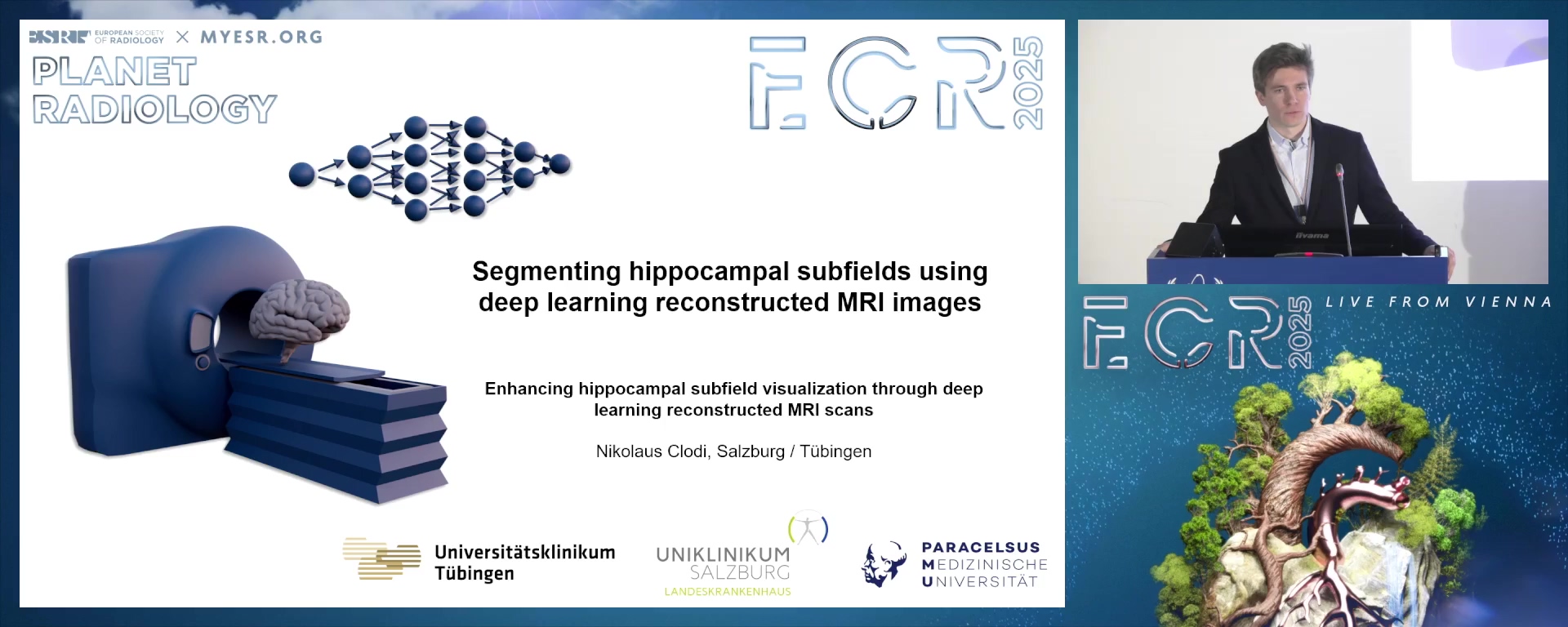 Segmenting hippocampal subfields using deep learning reconstructed MRI images