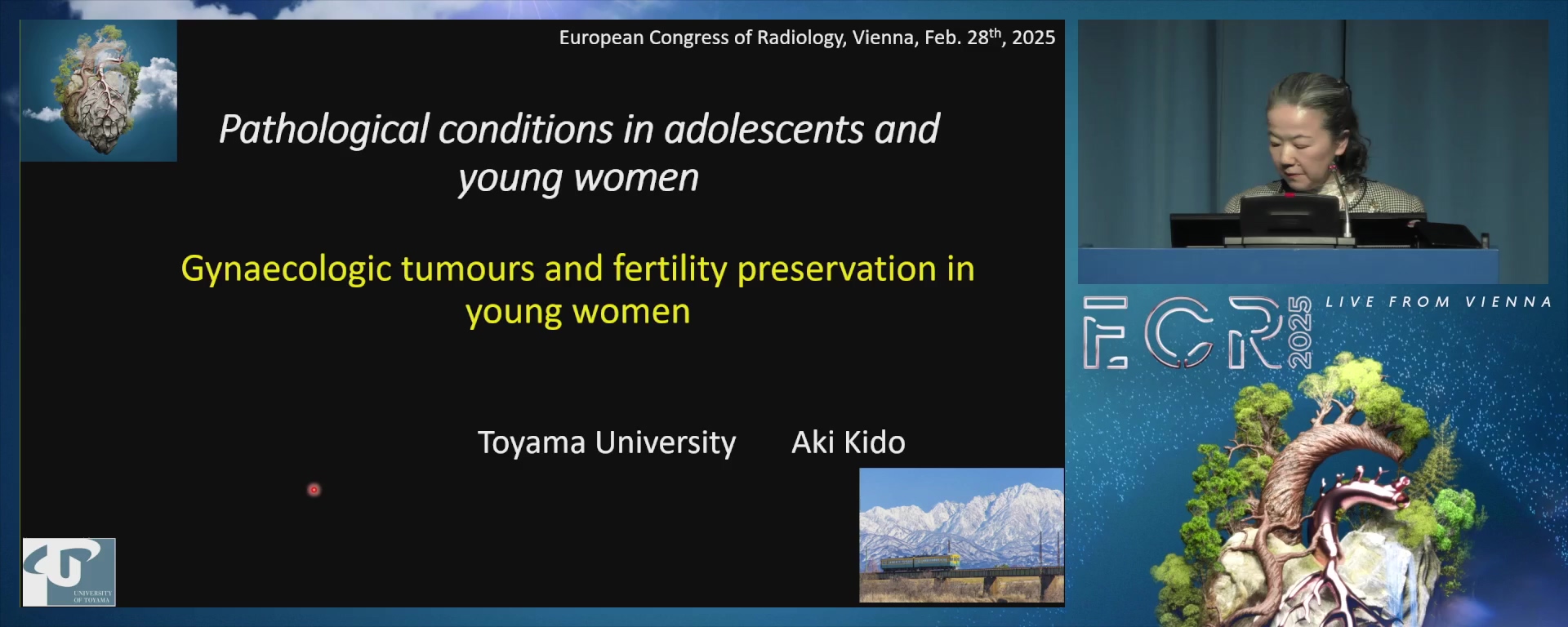Gynaecologic tumours and fertility preservation in young women
