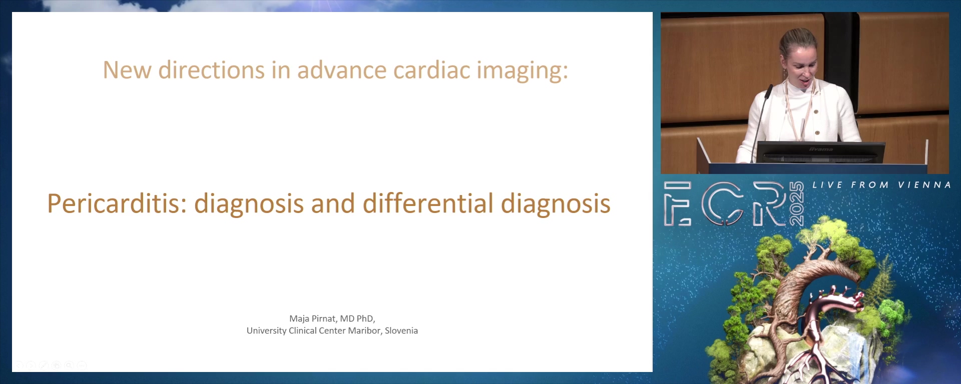 Pericarditis: diagnosis and differential diagnosis