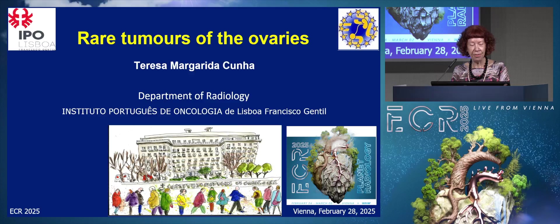 Rare tumours of the ovaries