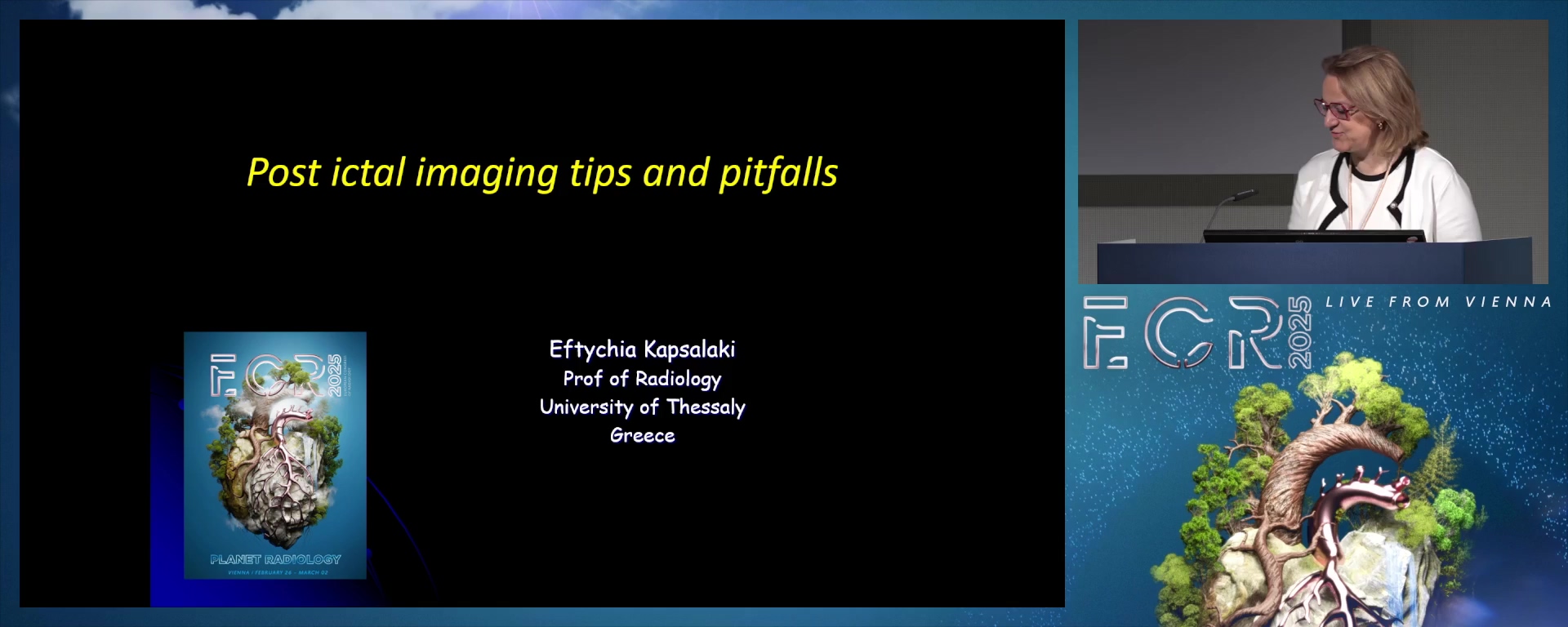Postictal imaging: tips and pitfalls