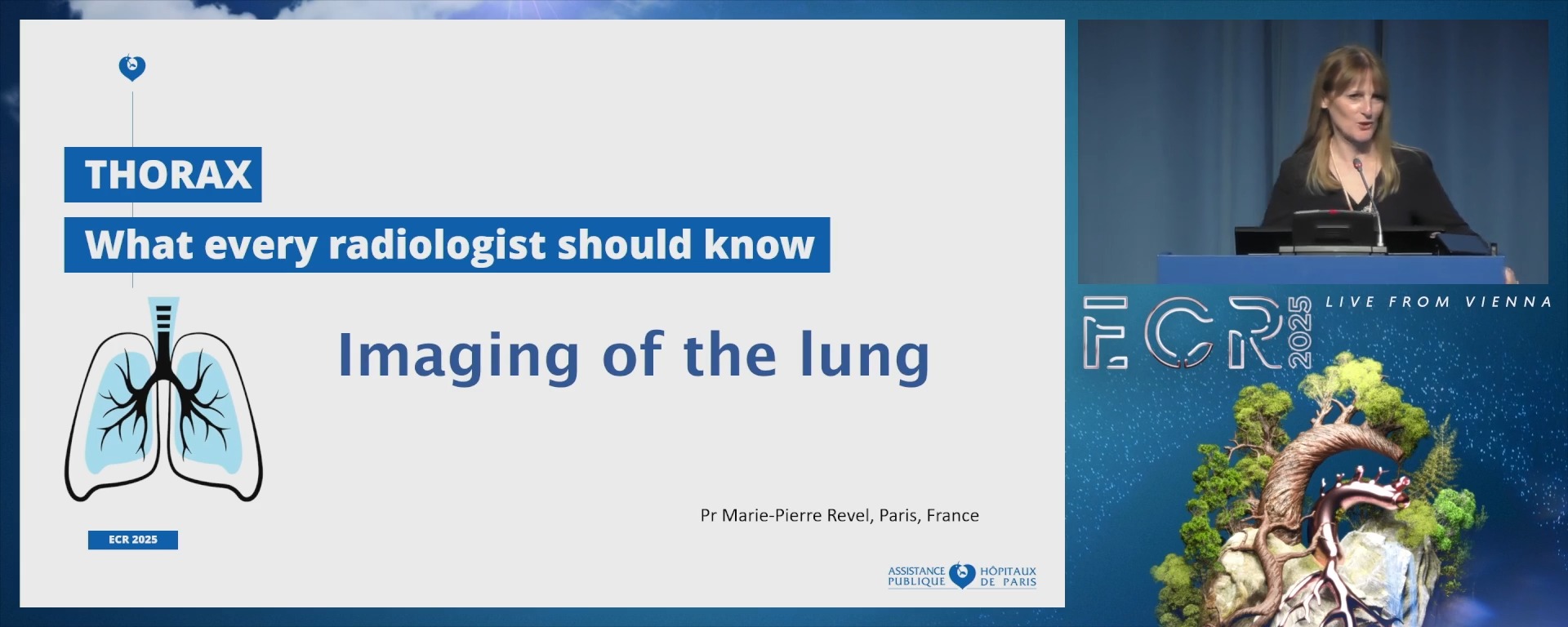 Imaging of the lung