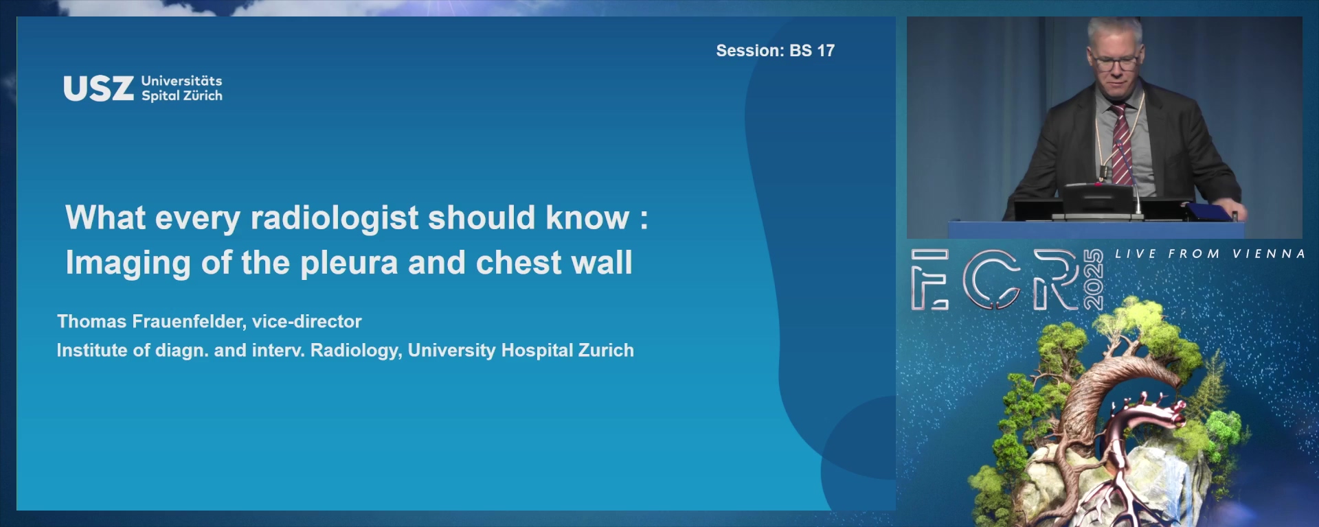 Imaging of the pleura and chest wall