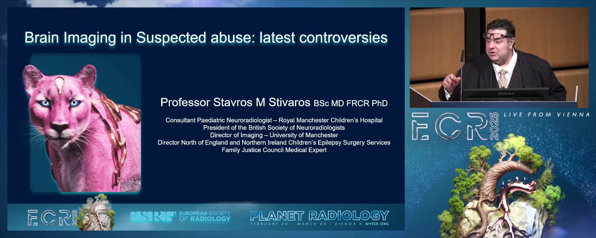Brain imaging in suspected abuse: latest controversies