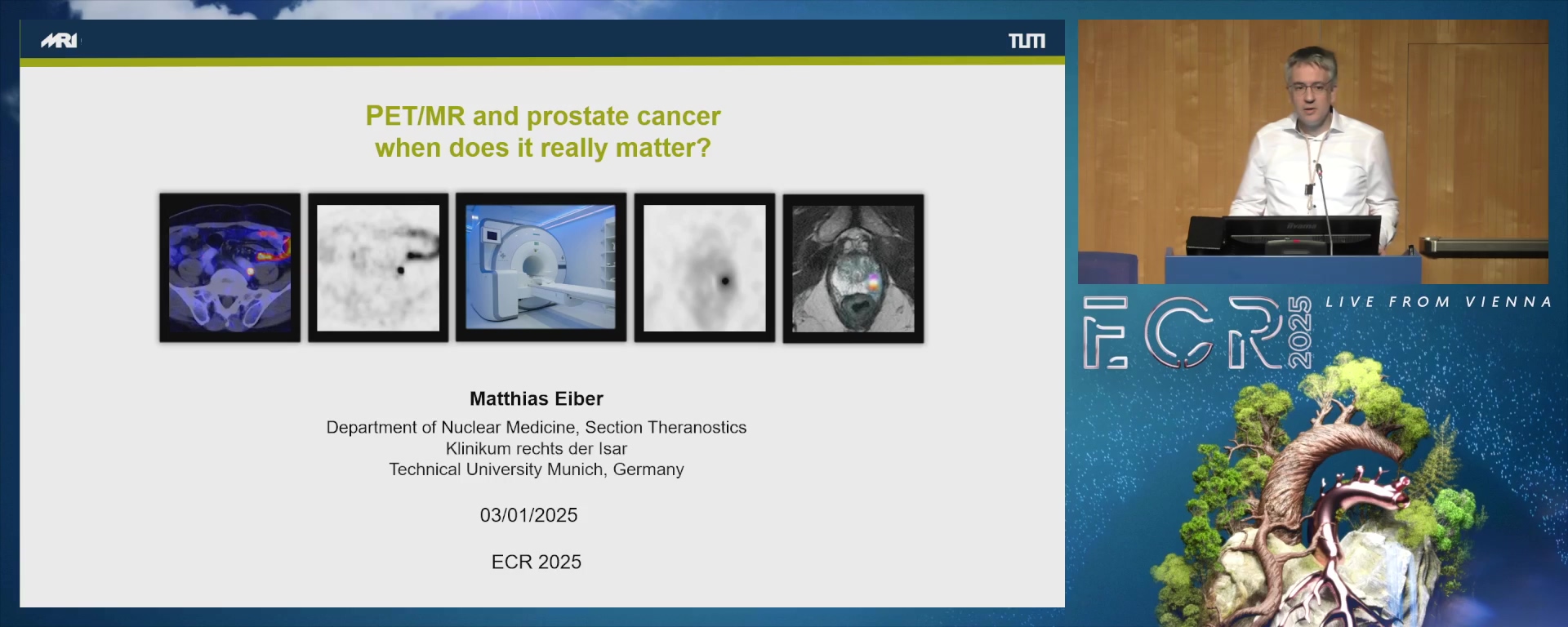 PET/MR and prostate cancer: when does it really matter?