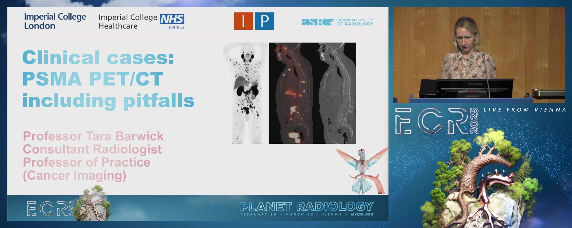 Clinical cases: whole-body PSMA PET/CT incl. pitfalls