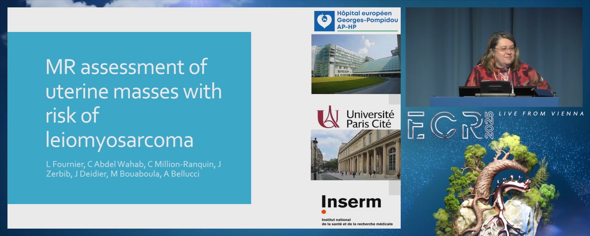MR assessment of uterine masses with risk of leiomyosarcoma