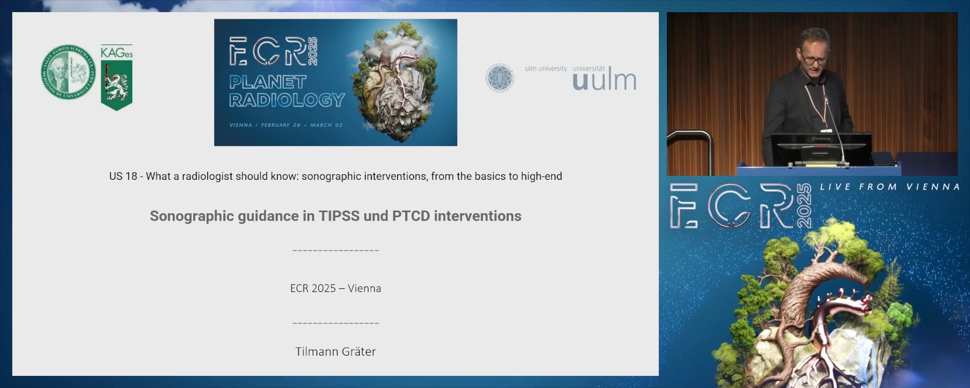 Sonographic guidance in TIPSS and PTCD interventions