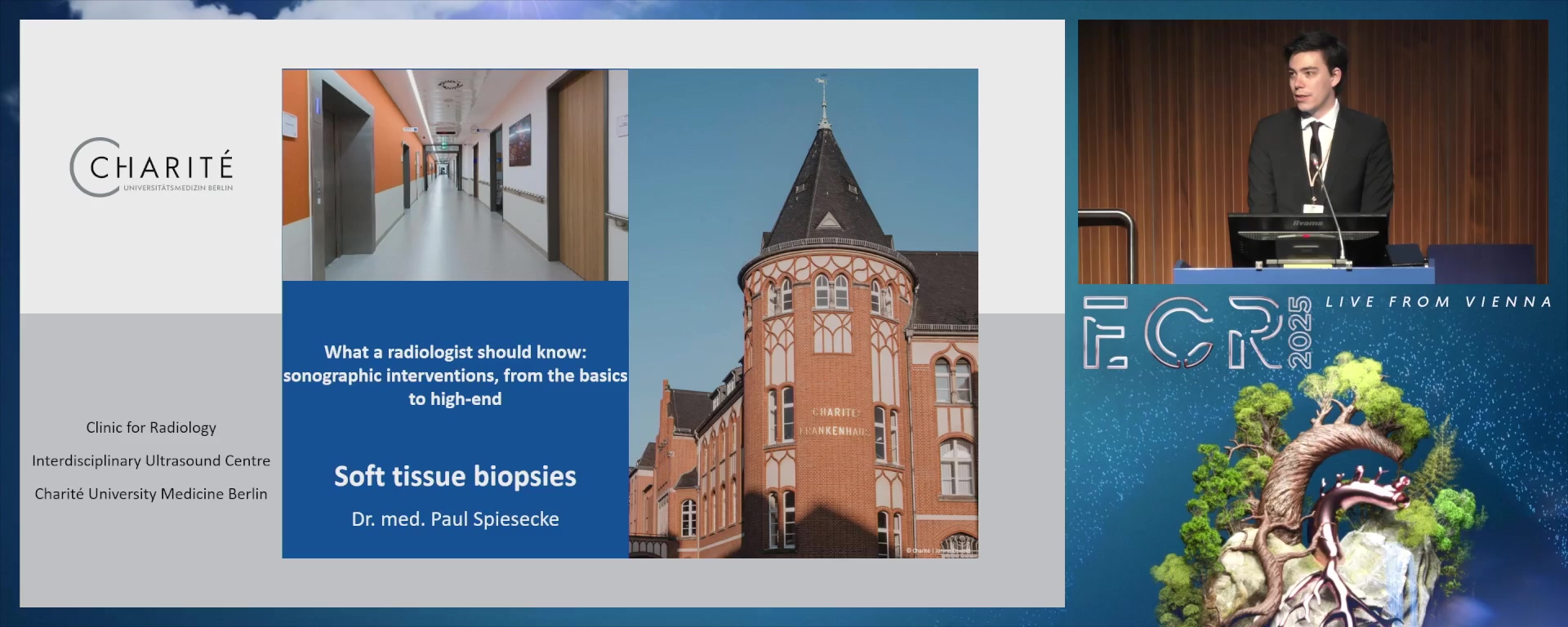 Soft tissue biopsies, including lymph nodes and sarcomas