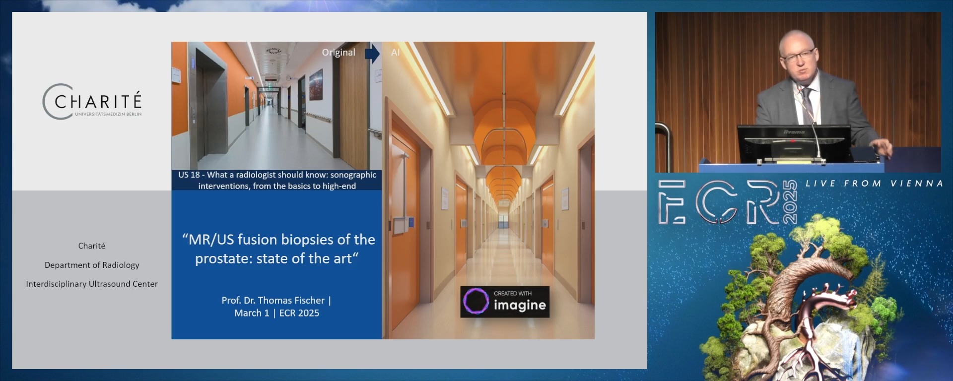 MR/US fusion biopsies of the prostate: state of the art