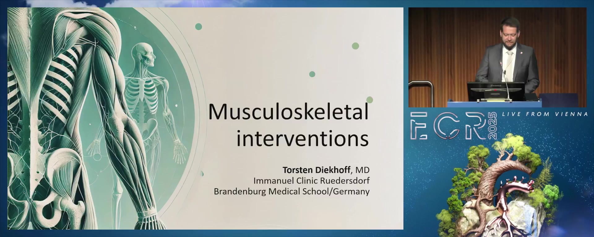 Musculoskeletal interventions