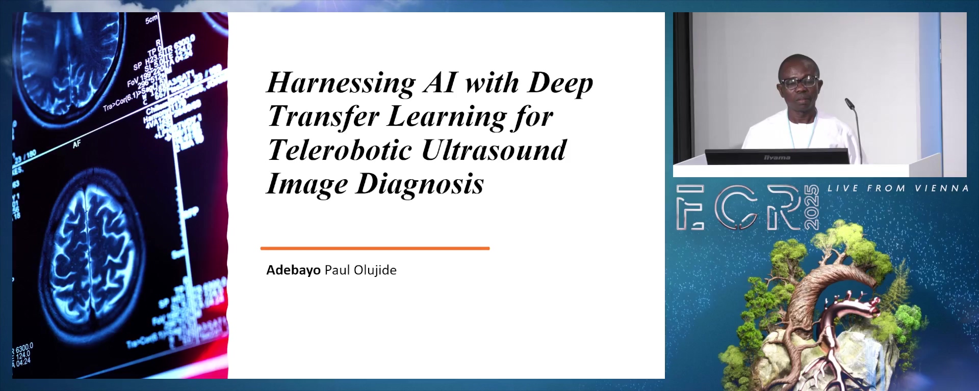 Harnessing AI with deep transfer learning for telerobotic ultrasound image diagnosis