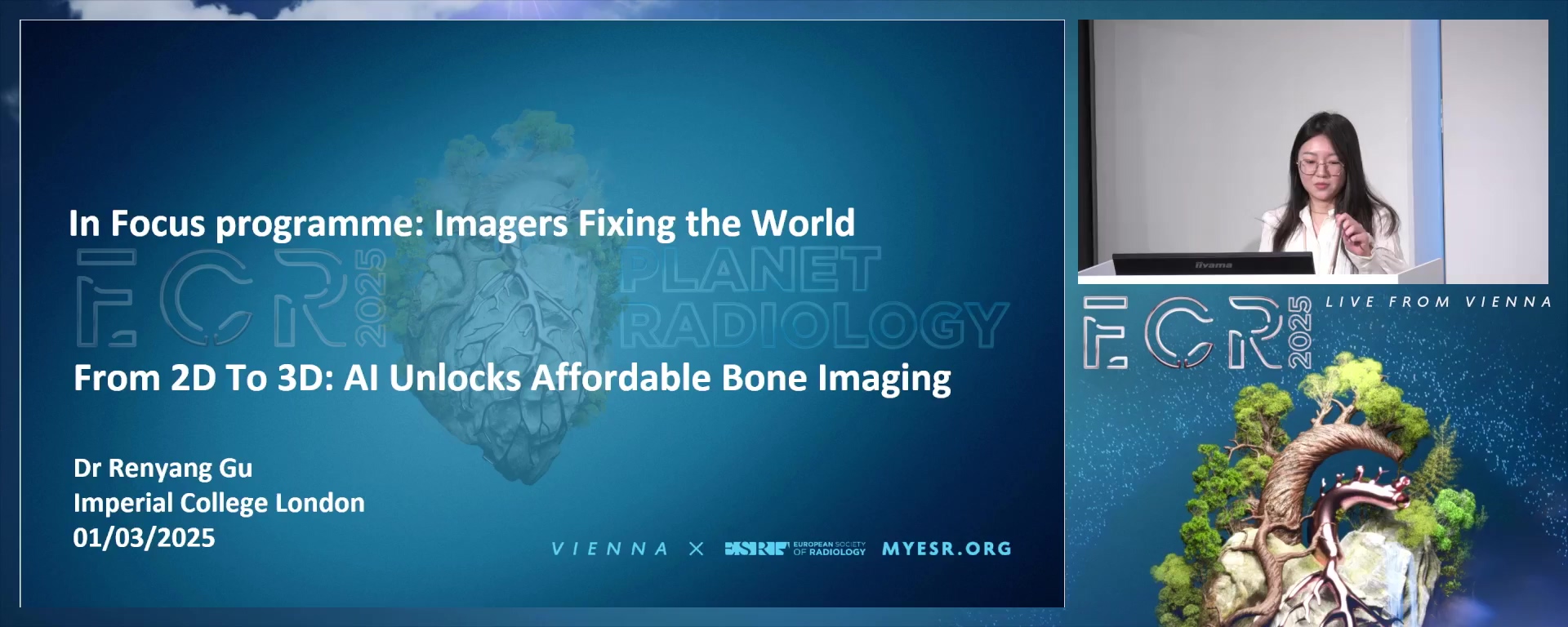 From 2D to 3D: AI unlocks affordable bone imaging