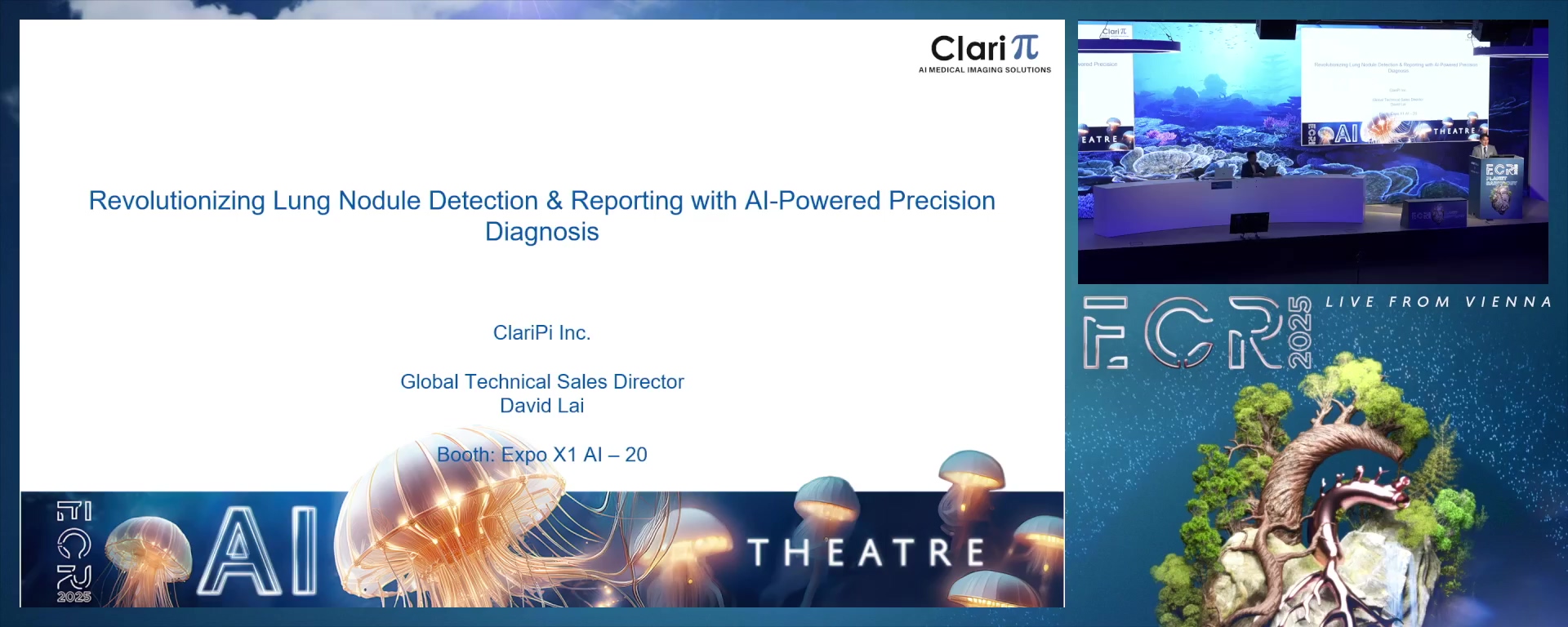 Revolutionizing Lung Nodule Detection & Reporting with AI-Powered Precision Diagnosis