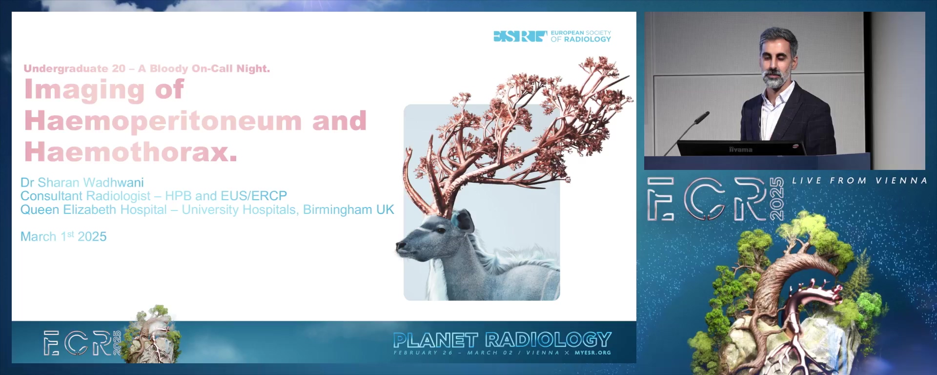 Imaging of hemoperitoneum and haemothorax