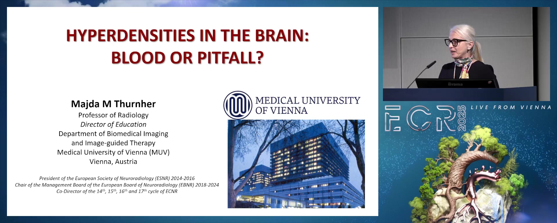 Hyperdensities in the brain: blood or pitfall?