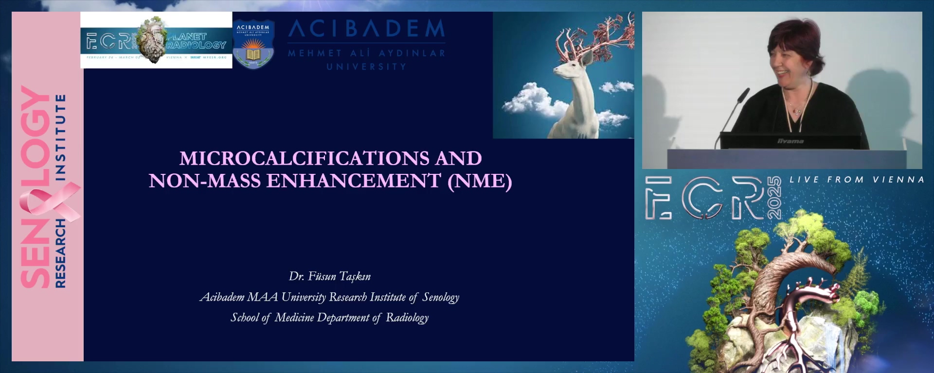 Microcalcifications and non-mass enhancement (NME)