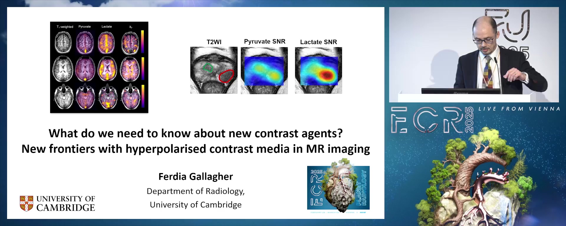 New frontiers with hyperpolarised contrast media in MR imaging