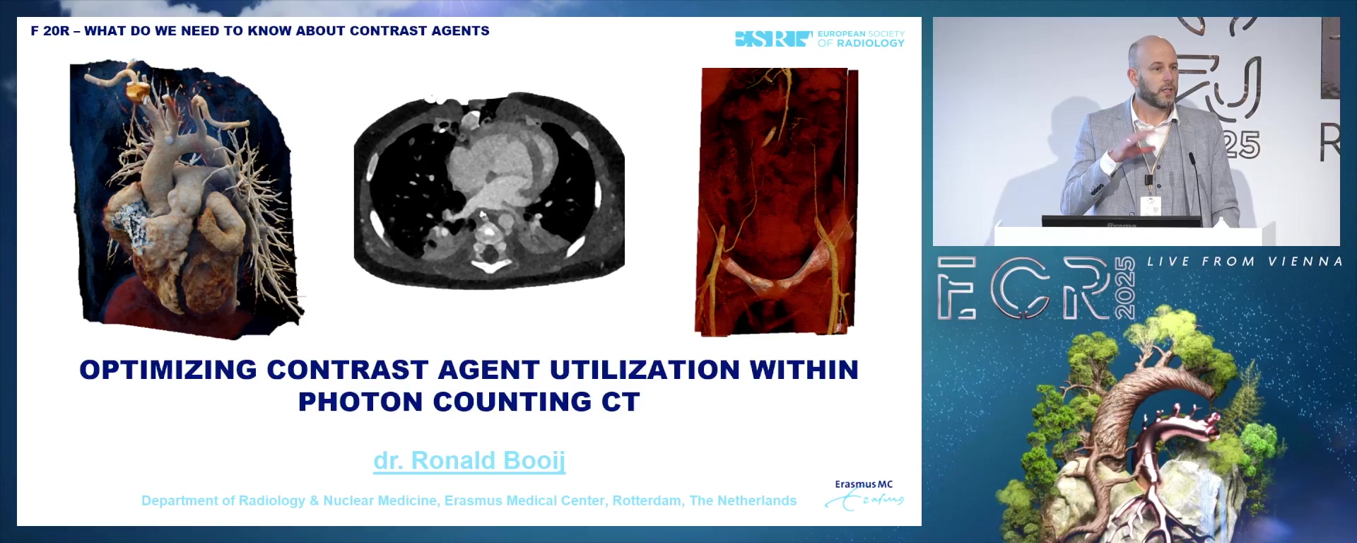 Optimising contrast agent utilisation within photon counting CT