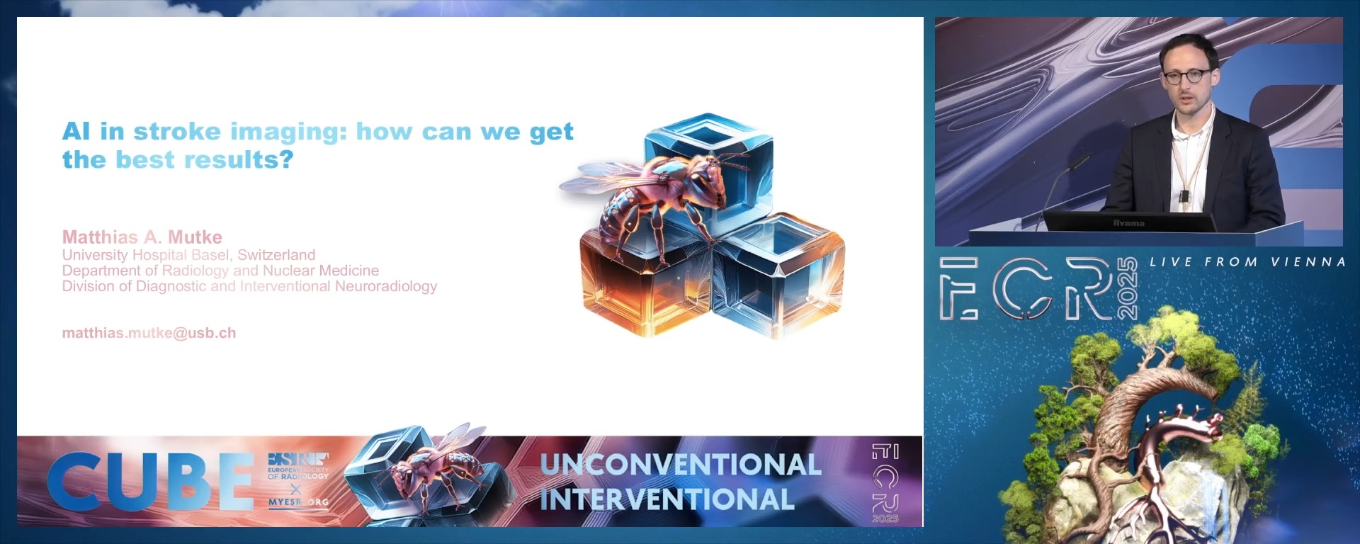 AI in stroke imaging: how can we get the best results?