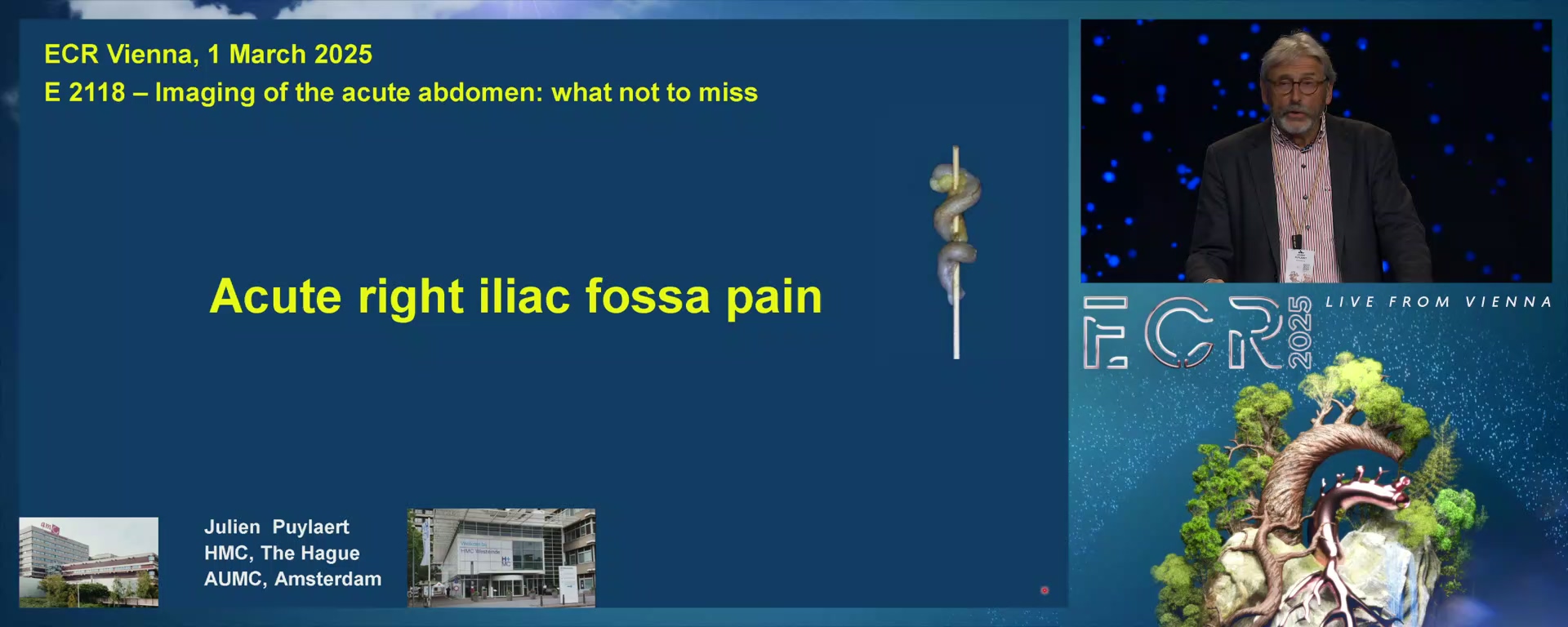 Acute right iliac fossa pain