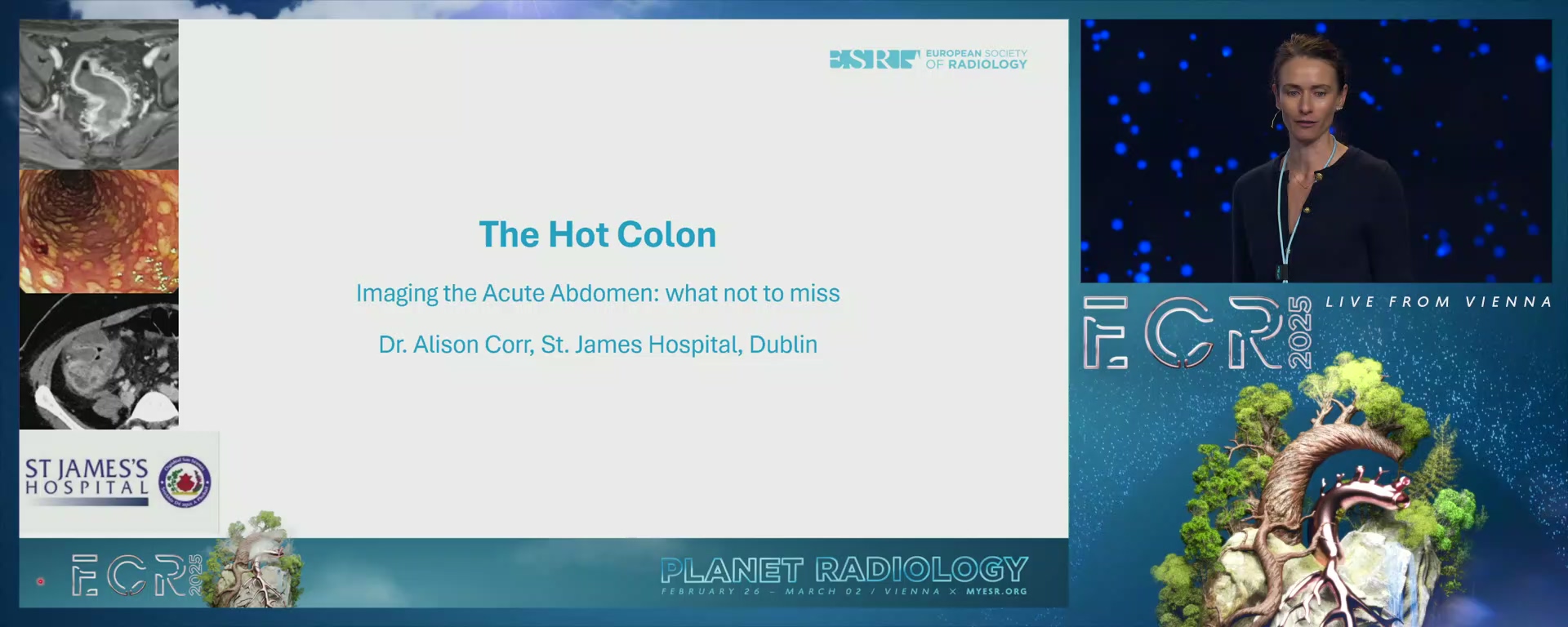 The hot colon