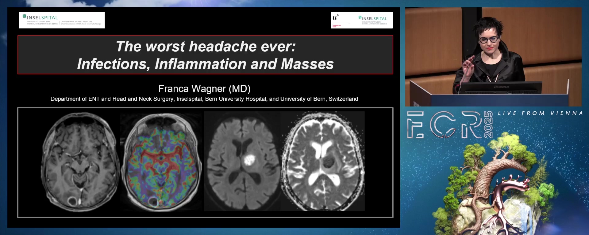 The worst headache ever: infections, inflammation and masses