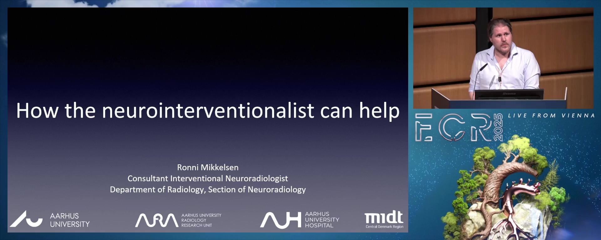 The worst headache ever: how the neurointerventionalist can help