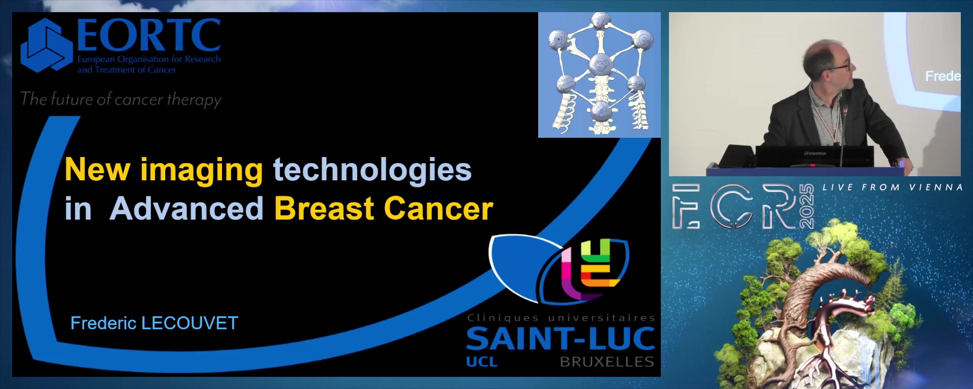 New imaging technologies for advanced breast cancer