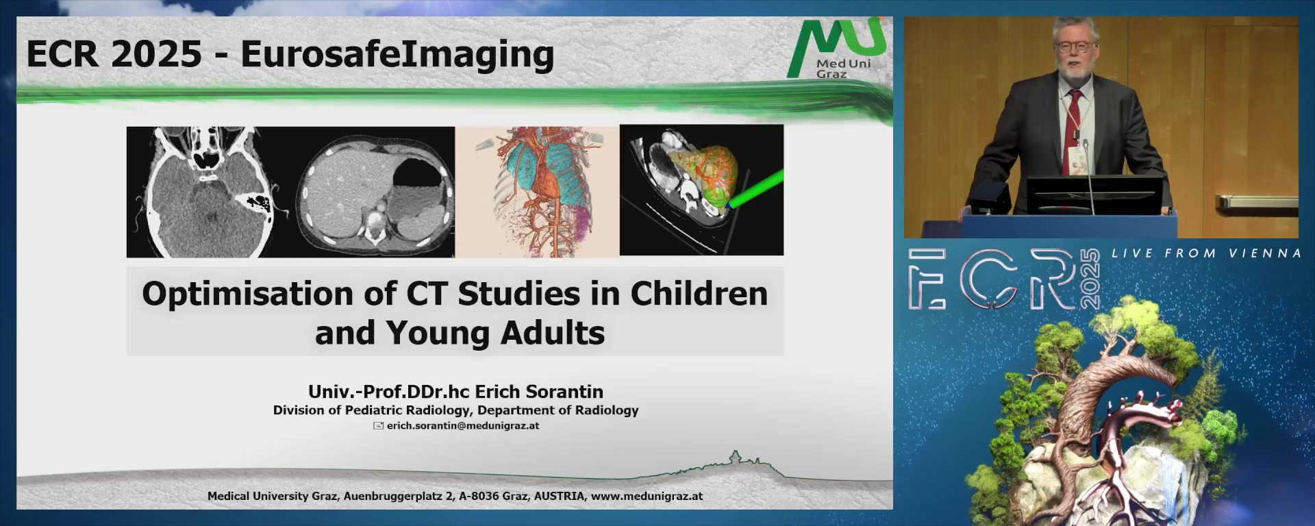 Optimisation of CT studies in children and young adults
