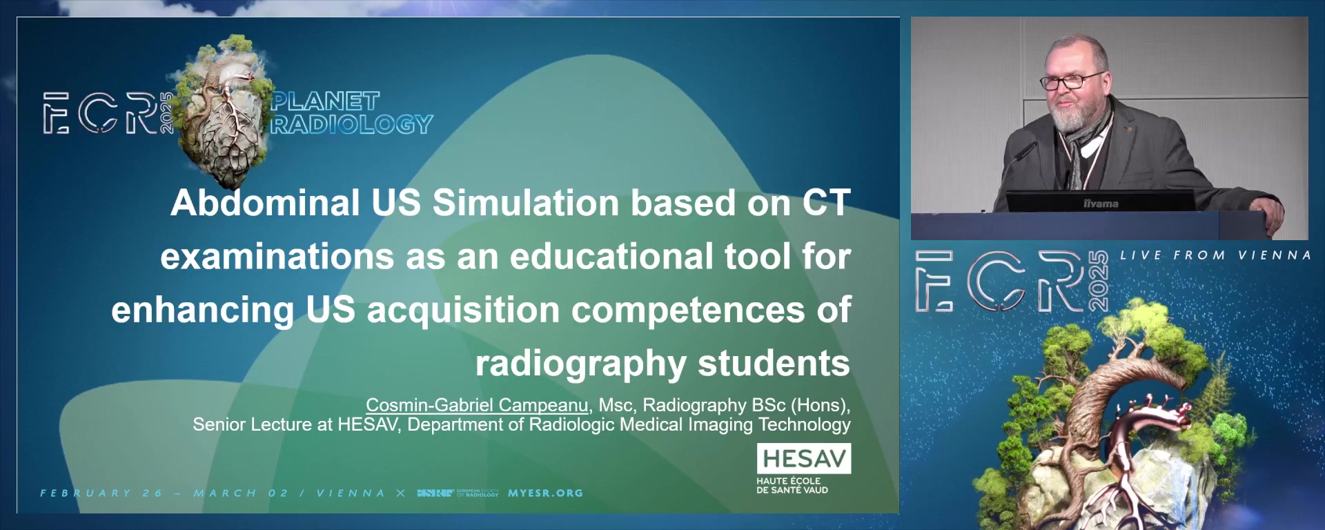 Abdominal Ultrasound Simulation based on CT examinations as an educational tool for enhancing Ultrasound acquisition competences of radiography students