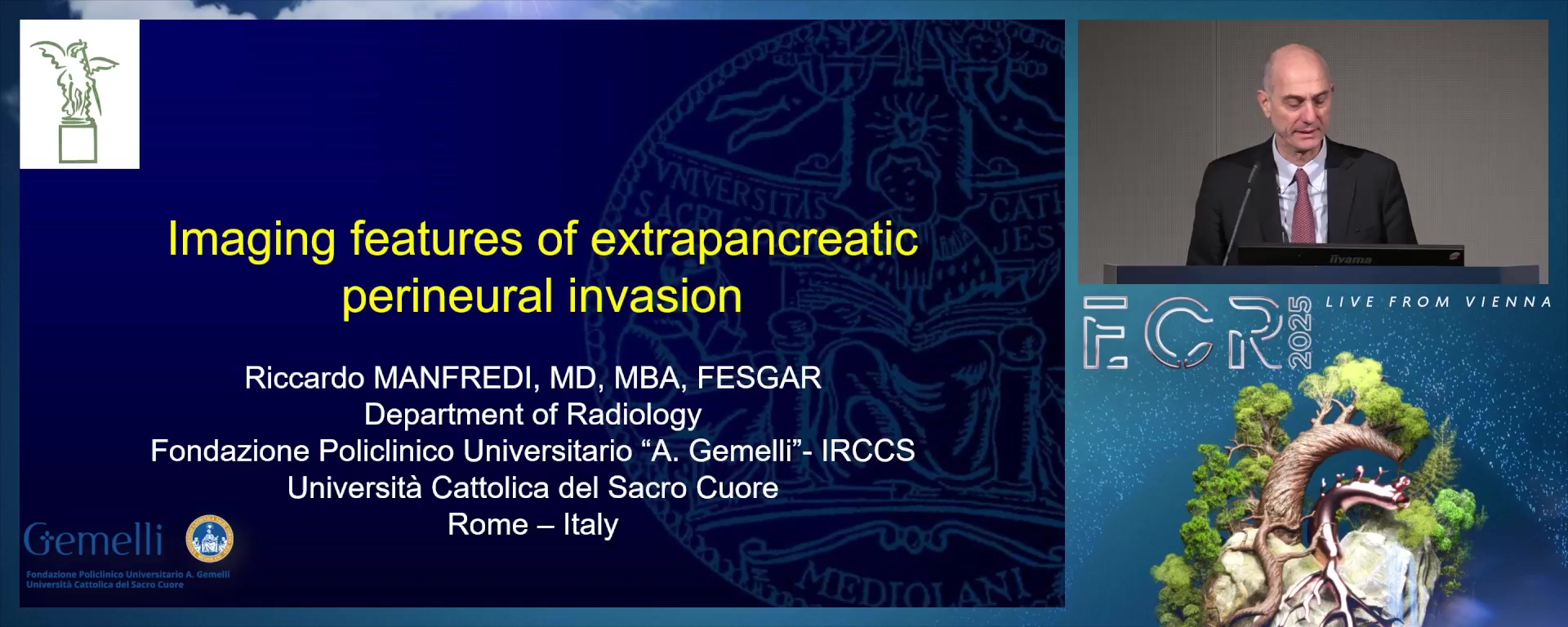 Imaging features of extrapancreatic perineural invasion