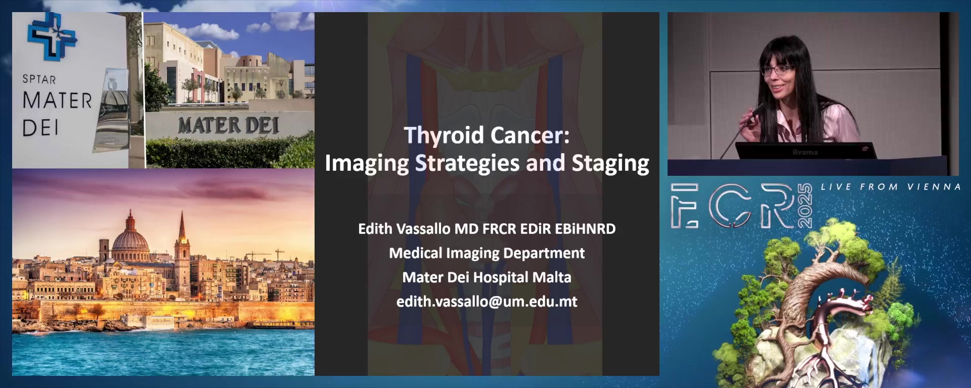 Thyroid cancer: imaging strategies and staging