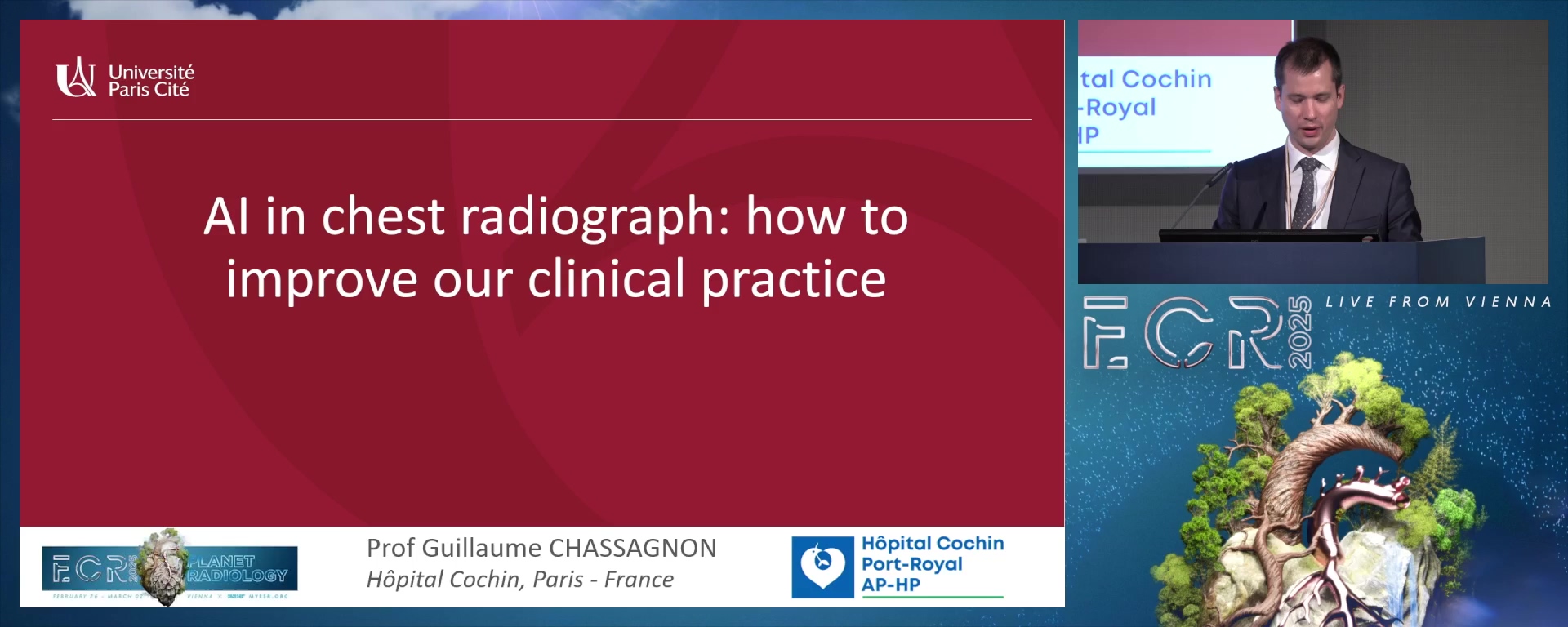 AI in chest radiograph: how to improve our clinical practice