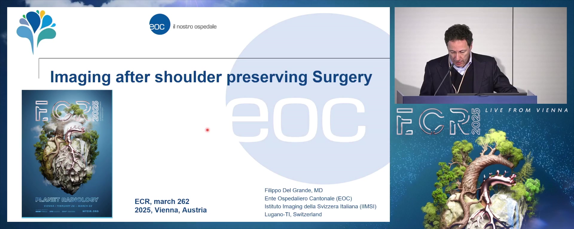 Imaging after shoulder preserving surgery