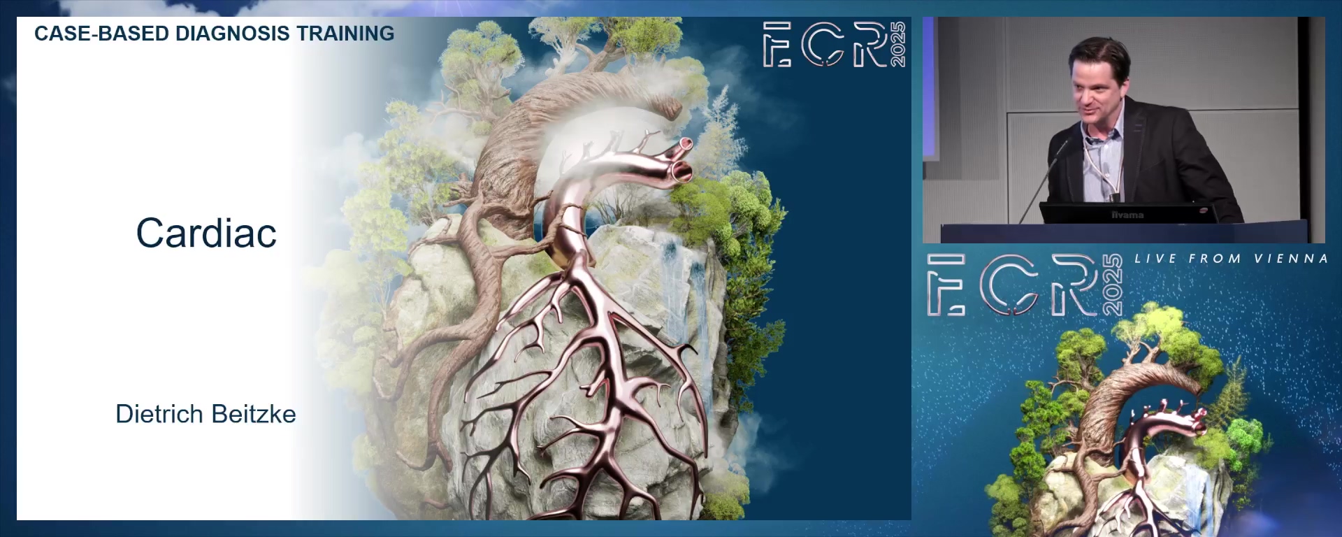 Cardiac