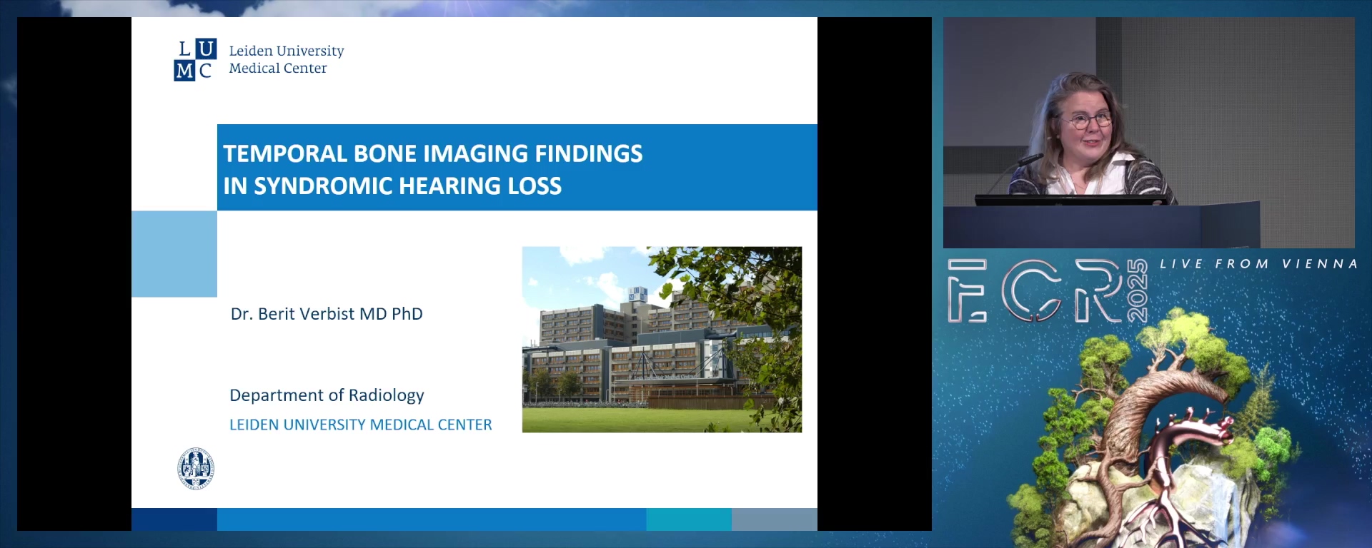Temporal bone imaging findings in syndromic hearing loss