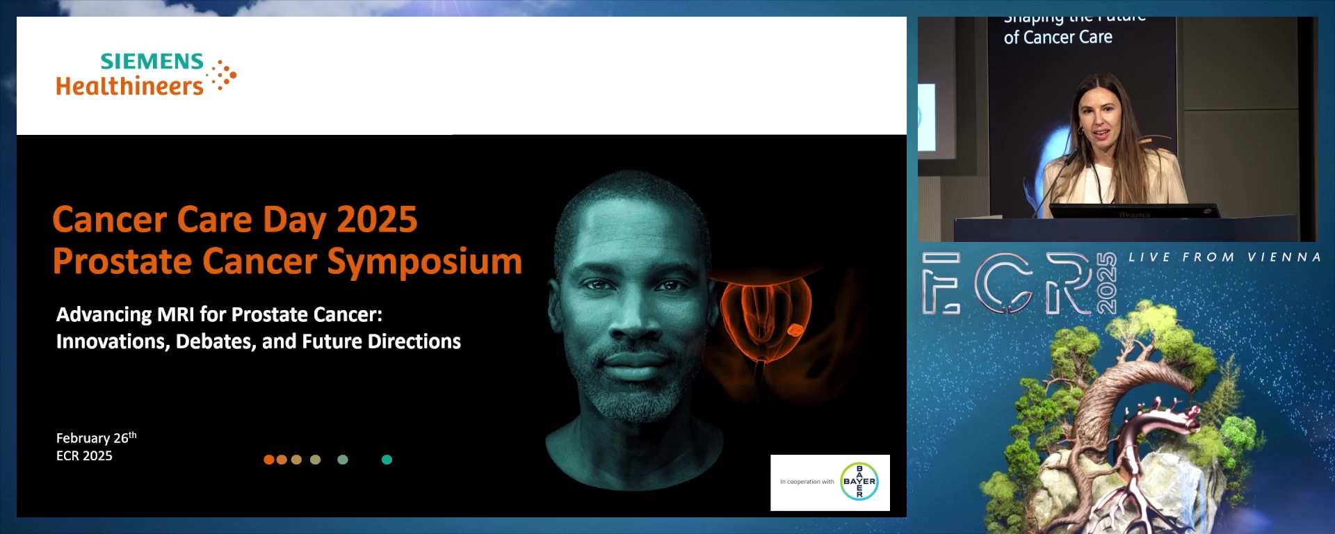 Advancing MRI for Prostate Cancer: Innovations, Debates, and Future Directions (Complete Session)
