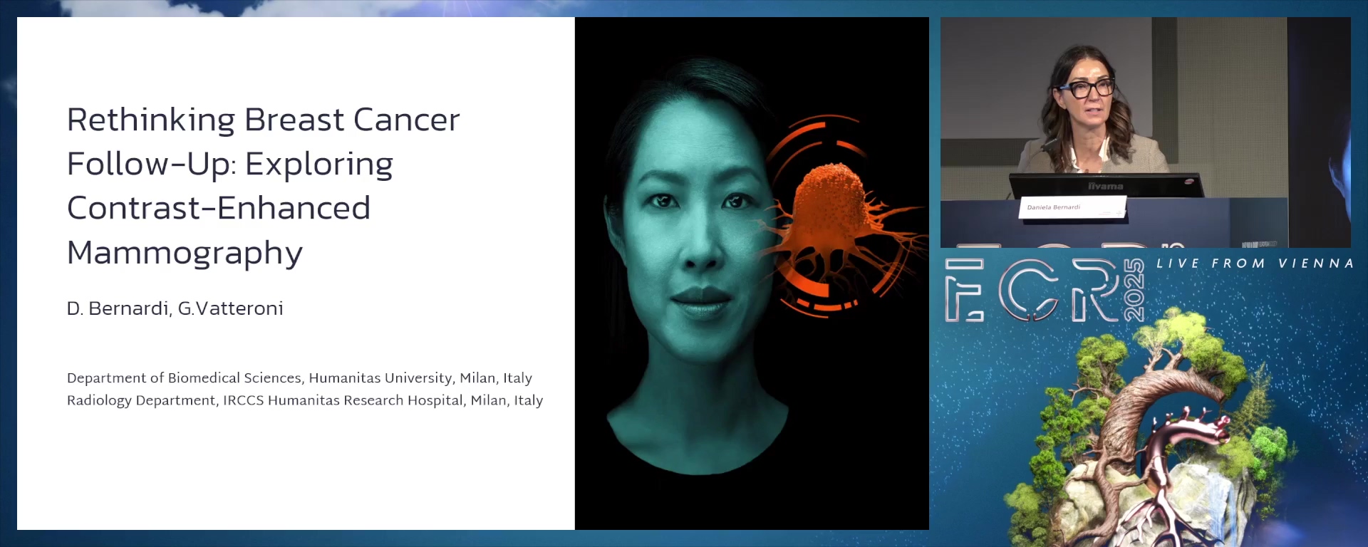 Advances in Breast Screening: imaging options for personalized diagnostics (Complete Session)