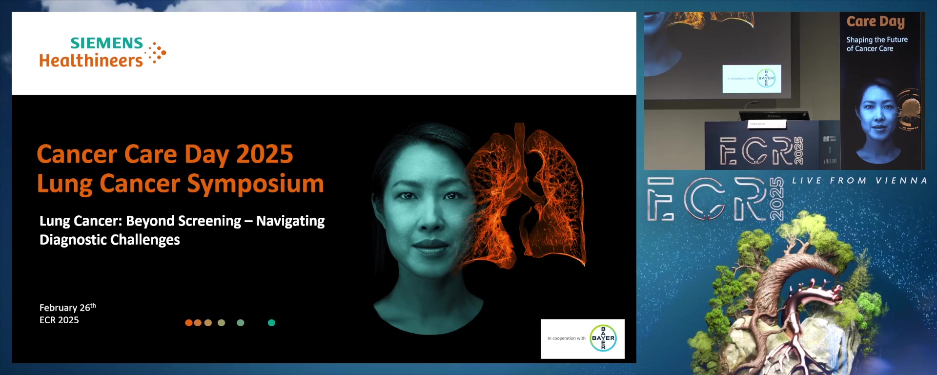 Lung Cancer: Beyond Screening – Navigating Diagnostic Challenges (Complete Session)