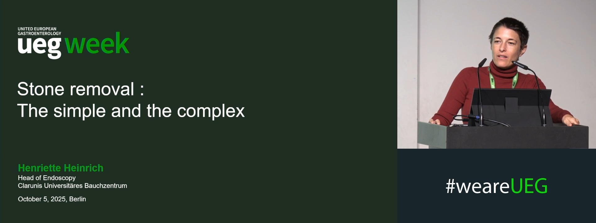 Stone removal: The simple and the complex