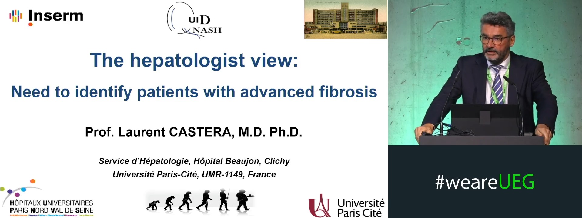 The hepatologist view: Need to identify patients with advanced fibrosis