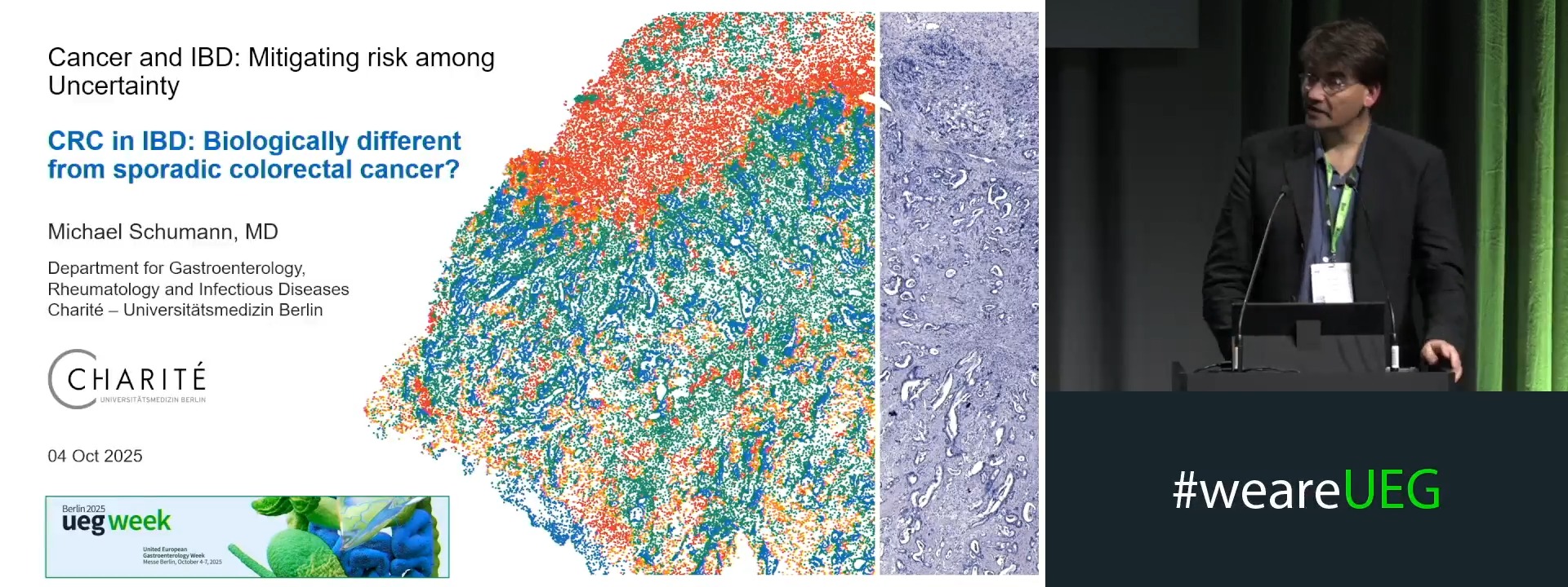 CRC in IBD: Biologically different from sporadic colorectal cancer?