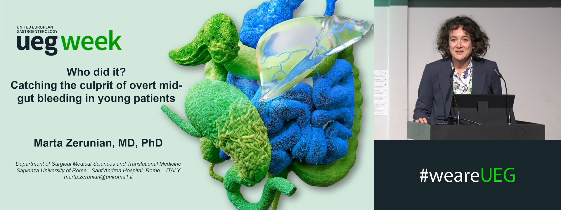 Who did it? Catching the culprit of overt mid-gut bleeding in young patients