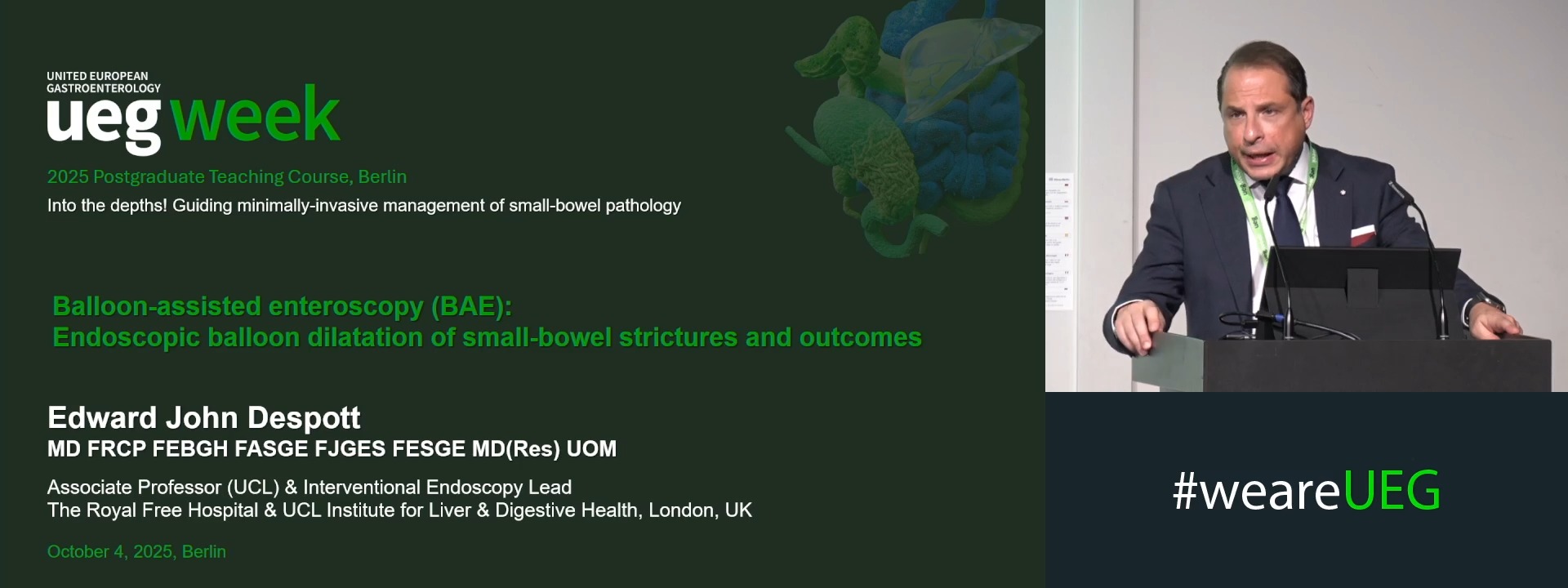 BAE-endoscopic balloon dilatation of small-bowel strictures and outcomes