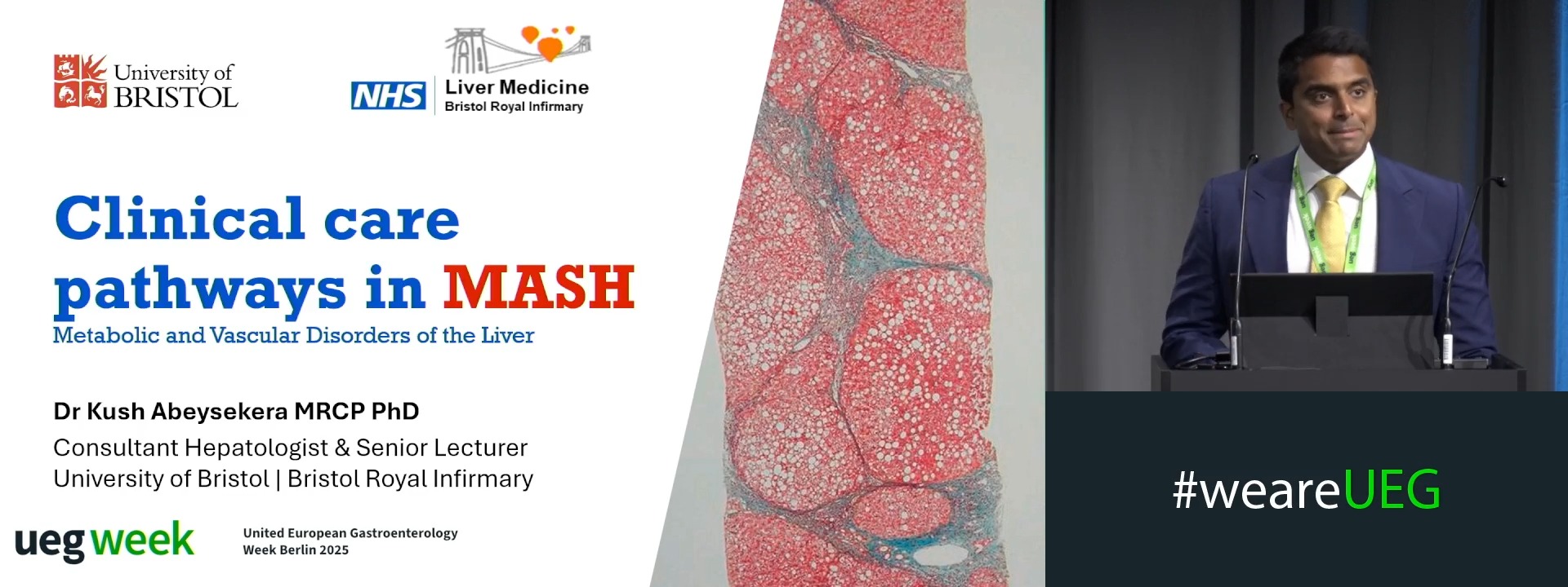 Clinical care pathways in MASH