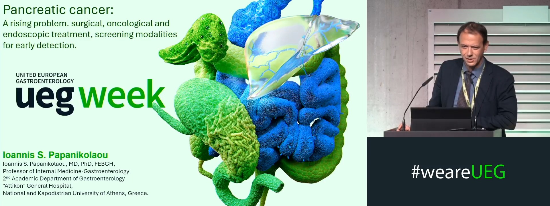 Pancreatic cancer - a rising problem. Surgical, oncological and endoscopic treatment, screening modalities for early detection